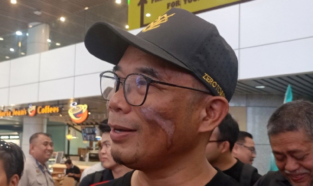 "Muka saya sampai beku tetapi alhamdulillah dengan bantuan sherpa berpengalaman kami berjaya" - Kicok